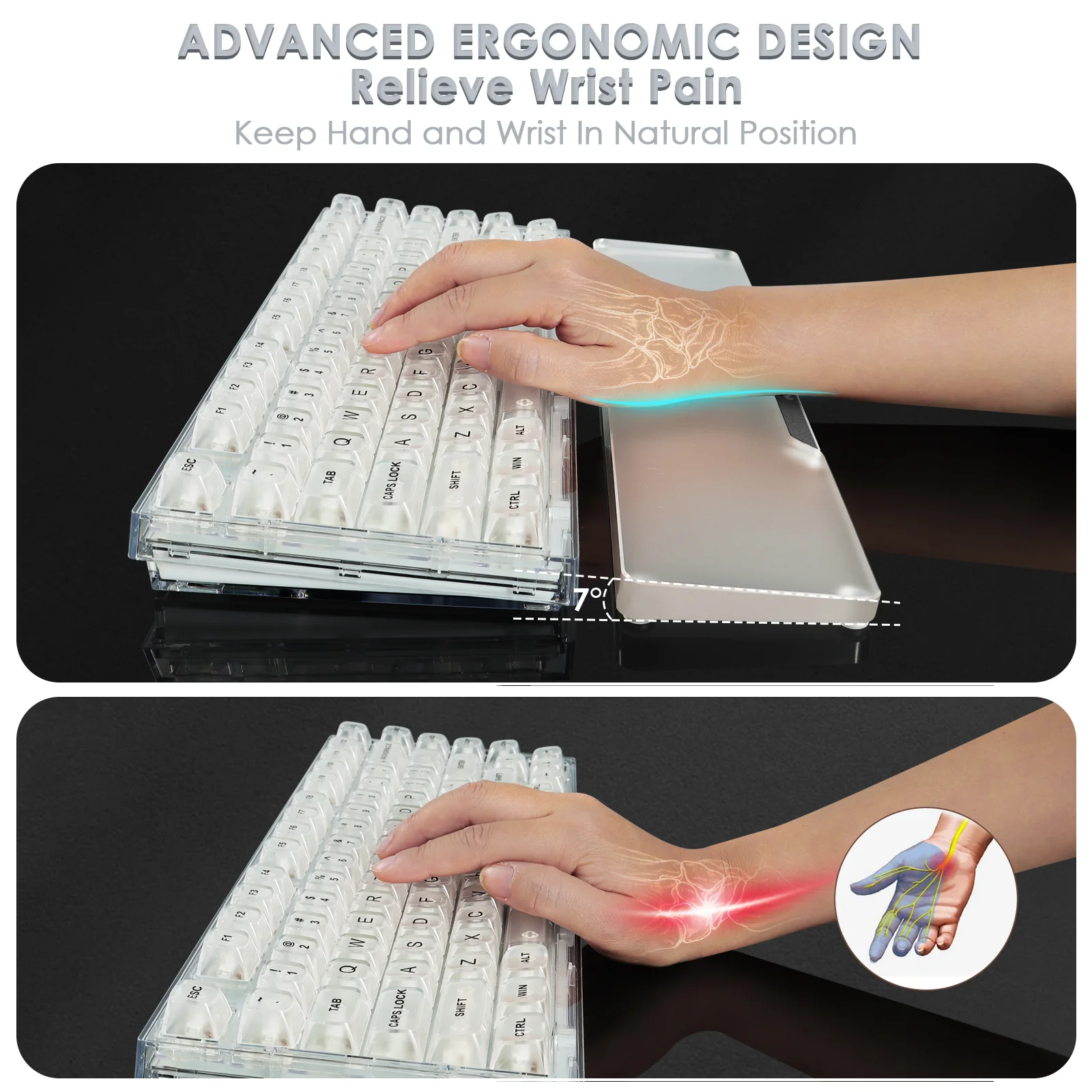 ATTACK SHARK 87 KEYS ACRYLIC WRIST REST - Image 6